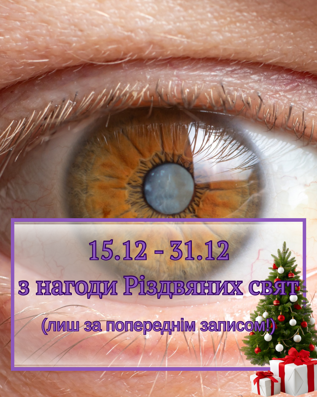 Безкоштовне обстеження зору для пенсіонерів з нагоди Різдвяних свят з 15.12 по 31.12 (лиш за попереднім записом)